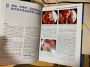 內(nèi)鏡鼻竇外科學(xué) 第4版剖學(xué)基礎(chǔ)CT三維重建和手術(shù)技術(shù)張羅診斷治療學(xué)顱底手術(shù)影像書籍人民衛(wèi)生出版社耳鼻咽喉頭頸外科學(xué)醫(yī)學(xué)書籍 曬單實(shí)拍圖