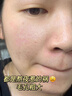 潤凰韓國乳糖酸毛孔收縮精華液收縮毛孔粗大修復(fù)細(xì)致祛粉刺閉口 縮小毛孔改善毛孔收斂水女男士 曬單實拍圖