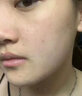 粉嫩公主 粉嫩公主寡肽原液30ml 痘印痘疤痘坑痘印精華液安瓶保濕補(bǔ)水 寡肽原液一瓶 曬單實拍圖