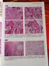 【新華文軒】乳腺組織病理學(xué)圖譜(全2冊) 正版書(shū)籍 新華書(shū)店旗艦店文軒 北京科學(xué)技術(shù)出版社 曬單實(shí)拍圖