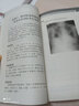 內(nèi)科會診病例精粹 曬單實(shí)拍圖