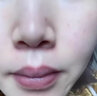 FLYMAN去痣點(diǎn)痣膏醫(yī)用專用官方正品點(diǎn)祛痣膏祛斑霜點(diǎn)痣非藥的水點(diǎn)痣點(diǎn)疣 拍一發(fā)五（告別黑痣無痛脫落） 曬單實(shí)拍圖