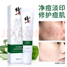 修正草本植萃痘肌修護凝膠祛痘膏青春痘印蘆薈膏痘坑毛孔黑頭粉刺 祛痘凝膠*1 曬單實(shí)拍圖