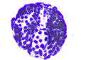 Phenix凤凰三目生物显微镜PH100-3B41L-IPL专业级无限远光学系统高倍高清实验室医学用 套餐一：显微镜+600万PRO接电脑（大景深） 实拍图