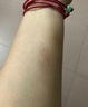 百幽草疤痕凈護(hù)理軟膏去祛傷疤膏燒燙傷手術(shù)妊娠紋痘印痘痕凹凸疤 1瓶裝【建議按療程使用】 曬單實(shí)拍圖