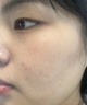 個(gè)人護(hù)理激光點(diǎn)痣筆去痣神器掃斑無痕9檔去痣點(diǎn)斑點(diǎn)疣點(diǎn)瘊點(diǎn)痦子 香檳金DYW-E0621 曬單實(shí)拍圖