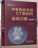 中樞神經(jīng)系統(tǒng)CT和MR鑒別診斷(第3版)(精) 曬單實(shí)拍圖