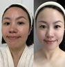 維特絲377精華水乳液美白祛斑補(bǔ)水保濕男女士護(hù)膚品淡化黑色素舒緩修護(hù) 曬單實(shí)拍圖