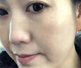 璀璨黑科技洗眉機(jī)無創(chuàng)不加水便攜式光感祛斑皮秒大功率洗紋身機(jī)器 黑色 璀璨黑科技高配款深邃黑 曬單實(shí)拍圖