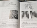 全套 醫(yī)學(xué)影像學(xué)讀片診斷圖譜 胸部分冊(cè)頭頸分冊(cè)腹部分冊(cè)骨肌分冊(cè)肌骨影像讀片書籍診斷學(xué)入門技術(shù)書ct解剖基礎(chǔ)指南初學(xué)實(shí)用大全 曬單實(shí)拍圖