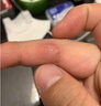 日本原裝進(jìn)口扁平疣軟膏 扁平疣面部臉部去除眼部頸部脖子手足部肉刺 香港直郵原裝進(jìn)口 日本扁平疣軟膏10g 1支裝 曬單實(shí)拍圖