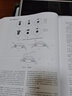 眼科手術(shù)學(xué)第三版3版葛堅劉奕志眼科醫生眼科學(xué)準分子激光玻璃體視網(wǎng)膜手術(shù)外斜視屈光手術(shù)學(xué)人民衛生出版社旗艦店眼科書(shū)籍 曬單實(shí)拍圖