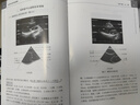 【正版現(xiàn)貨】超聲標準切面圖解（修訂版）張梅編 超聲診斷學 超聲診斷書籍 9787030590220 曬單實拍圖