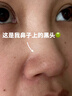 fUT【買(mǎi)1送1】毛孔排出臟東西 去淡化黑頭閉口粉刺清潔泥膜男女 【到手24包】改善黑頭 曬單實(shí)拍圖