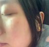 莘護疤痕修復凝膠成人醫用硅酮透明質(zhì)酸凝膠疤痕膏疤痕輔助改善預防醫用疤痕凝膠15g 曬單實(shí)拍圖