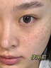 同仁堂強效第1名祛斑霜美白淡化老年黃褐雀斑黑色素斑去黑色素專用男女 1瓶【3天見效】50g 曬單實拍圖