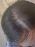 蔓迪男女士生发喷雾米诺地尔酊30ml防脱育发头发增长发际线生长液药护发产后脱发凝胶搽剂曼迪 实拍图