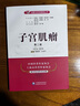 子宮肌瘤（第二版）/名醫與您談疾病叢書(shū) 曬單實(shí)拍圖