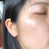 卓姿泉杏仁酸水楊酸精華液乳糖酸原液果酸黑頭閉口粉刺痘痘毛孔粗大可用 1瓶/30ml 曬單實(shí)拍圖