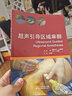 超聲引導區(qū)域麻醉 曬單實拍圖
