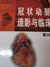 冠狀動(dòng)脈造影與臨床 第3版 李占全金元哲 冠脈造影介入心臟病學(xué) 心血管內科外科醫師冠狀動(dòng)脈造影參考書(shū)籍遼寧科技出版社9787538173574 曬單實(shí)拍圖