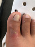 鯊鵜鶘洞洞鞋男夏季外穿拖鞋防滑軟底迪特潮流I韓版包頭沙灘鞋大頭涼鞋 迪特白黑底 41 曬單實拍圖