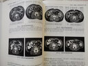 全國大型醫(yī)用設(shè)備上崗證考試用書醫(yī)療醫(yī)用影像設(shè)備CT/MRI/DSA成像原理臨床應(yīng)用磁共振儀器技師醫(yī)師技術(shù)cdfi彩超mr核磁人衛(wèi)教材 曬單實拍圖