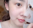 蟬王醫(yī)梵美燒燙傷擦傷割傷微整形激光術(shù)后修復(fù)面膜減少色素沉著痤瘡 一盒5片裝【連續(xù)使用一周】 曬單實拍圖