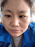 儷之康斗雞眼斜視矯正眼睛內(nèi)斜外斜訓(xùn)練器成人弱視眼貼兒童醫(yī)用葉黃素貼 熱敷眼貼買2送1 眼斜視視力模糊 曬單實(shí)拍圖