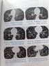 急診醫(yī)學（第2版/配增值）（國家衛(wèi)生健康委員會住院醫(yī)師規(guī)范化培訓規(guī)劃教材） 曬單實拍圖
