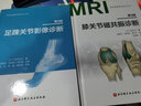 足踝關(guān)節(jié)影像診斷(第2版)(精)/骨肌影像診斷技巧叢書 曬單實(shí)拍圖