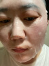 玉泽（Dr.Yu）皮肤屏障修护保湿面膜6片/盒（舒缓泛红  维稳补水  敏感肌专研） 实拍图