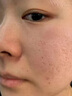 同仁堂祛痘印修復(fù)淡化痘印痘坑修復(fù)凹洞去痘坑去痘疤去痘痘和痘印粉刺 一盒體驗(yàn)裝【拍二發(fā)三】 曬單實(shí)拍圖