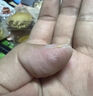 雞眼藥水足部腳底腳趾手指長(zhǎng)硬疙瘩肉刺跖疣去除老繭瘊子尤專用膏 特價(jià)一盒（預(yù)防護(hù)理） 曬單實(shí)拍圖