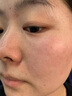 同仁堂祛痘印修復(fù)淡化痘印痘坑修復(fù)凹洞去痘坑去痘疤去痘痘和痘印粉刺 一盒體驗(yàn)裝【拍二發(fā)三】 曬單實(shí)拍圖