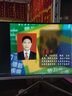 雅漫林針刀視頻U盤小針刀療法教學(xué)視頻教程理微診斷刀法手法教程優(yōu)盤 64G小針刀視頻全套 曬單實(shí)拍圖