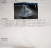 [好藥認證] 五淋化石膠囊 0.3g*60粒/盒 8盒裝 曬單實(shí)拍圖