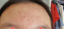 羽素藍(lán)銅肽亮妍表層凍干粉套盒美白淡印 凍干粉套盒28ml 曬單實(shí)拍圖