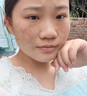 同仁堂（TRT）祛斑美白淡化黑色素?zé)燉０纺z祛斑霜去斑專用男女5 草本祛痘膏去痘痘和痘印 曬單實(shí)拍圖