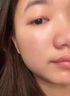 阿達(dá)帕林凝膠醫(yī)用祛痘消炎痤瘡專用藥膏去痘痘和痘印閉合性粉刺藥膏臉上長痘痘治療重度青春痘硬疙瘩皮膚用藥 1盒裝【粉刺膿包痘印】 曬單實拍圖