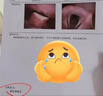 萬(wàn)秋堂進(jìn)口咽喉炎專(zhuān)用的藥咽炎慢性咽炎除i根喉嚨癢.干咳.異物感 中藥貼 一盒【體驗裝】無(wú)優(yōu)惠 曬單實(shí)拍圖