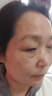 內(nèi)廷上用老年斑臉部手背祛斑專用霜去老人斑的藥強(qiáng)力祛除手部臉部日本進(jìn)口 1盒裝【醫(yī)用祛斑膏】多盒更劃算 男女士美白淡化老年黃褐雀斑黑色素點(diǎn)痣膏 曬單實(shí)拍圖