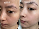 瑜然美臻奢美白淡斑精華液祛除頑固斑雀斑黃褐斑老年斑補(bǔ)水保濕女點(diǎn)斑筆 祛斑美白點(diǎn)斑筆20ml【3支裝】 曬單實(shí)拍圖