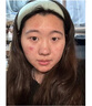 執(zhí)研敏感痘肌煥活霜祛痘女男士去痤瘡粉刺青春痘暗瘡疤痘印痕產(chǎn)品 20G 曬單實拍圖