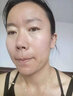 Revive Source凍干粉祛痘上火痘去粉刺閉口去痘痘寡肽多肽精華男女護(hù)膚品 祛痘粉刺閉口凍干粉【1盒12瓶】 曬單實(shí)拍圖