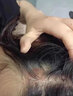 洗發(fā)水頭皮癬頭部牛皮癬脂溢性皮炎治銀屑i病去屑止癢頭皮外用液 三盒裝[買二送一] 曬單實(shí)拍圖