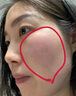 洛詩秘依克多因敏感肌膚護膚品套裝舒緩修護角質層薄屏障泛紅絲補水保濕 五盒強效裝效果好150ml多人推薦 曬單實拍圖
