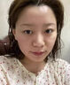 ning新加坡進口美白淡斑霜祛斑淡化提亮膚色改善暗沉淡化黑色素黃褐斑 曬單實拍圖