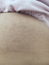 ASTACURE荷蘭妊娠紋油孕婦專(zhuān)用產(chǎn)前產(chǎn)后淡化孕紋修護霜預防生長(cháng)紋緊致80ml 曬單實(shí)拍圖