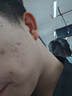 倩滋倩滋草本修護(hù)祛痘膏男女學(xué)生青春痘祛痘膏祛痘面霜 2瓶祛痘膏+1支洗面奶 40ml 曬單實(shí)拍圖